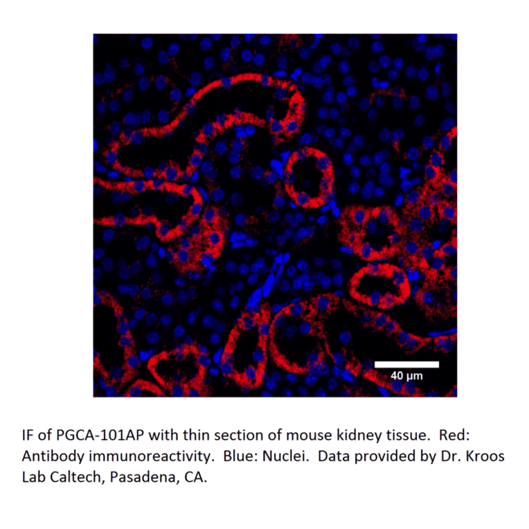 Anti-PGCA Antibody from FabGennix (PGCA-101AP) - Antibodies.com