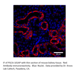 Anti-PGCA Antibody from FabGennix (PGCA-101AP) - Antibodies.com