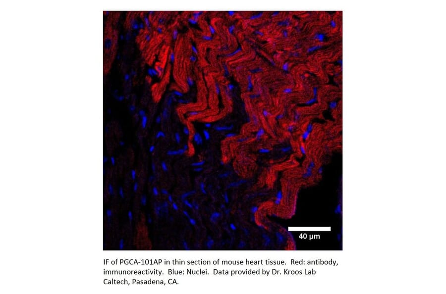 Anti-PGCA Antibody from FabGennix (PGCA-101AP) - Antibodies.com