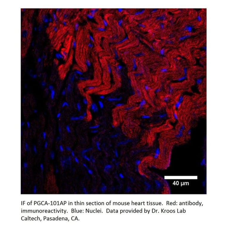 Anti-PGCA Antibody from FabGennix (PGCA-101AP) - Antibodies.com