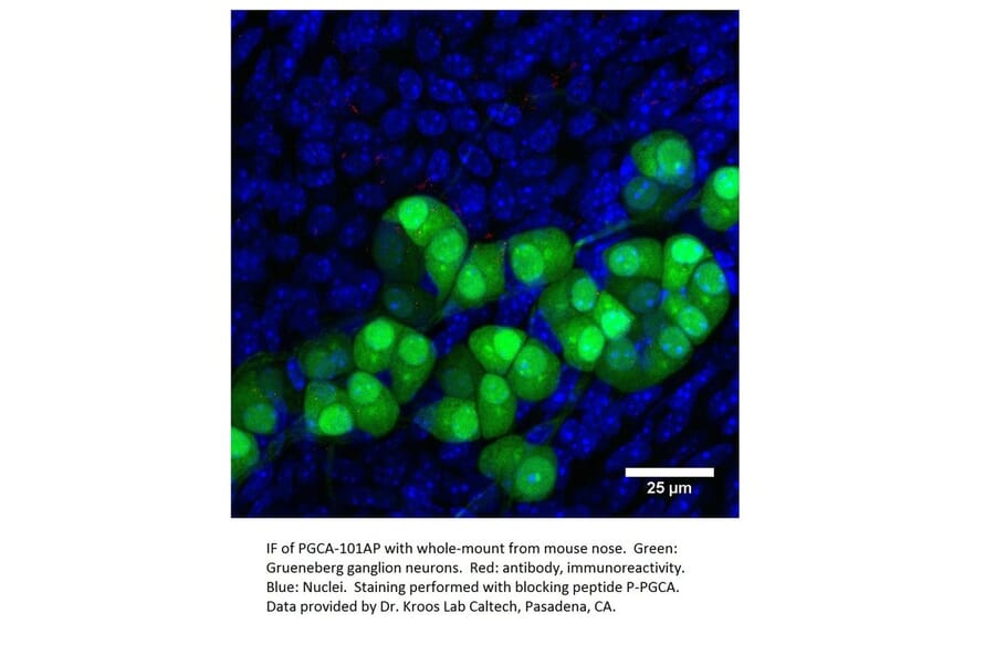 Anti-PGCA Antibody from FabGennix (PGCA-101AP) - Antibodies.com