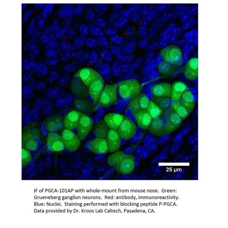 Anti-PGCA Antibody from FabGennix (PGCA-101AP) - Antibodies.com