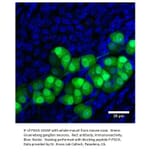 Anti-PGCA Antibody from FabGennix (PGCA-101AP) - Antibodies.com