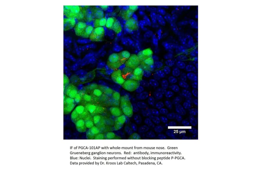 Anti-PGCA Antibody from FabGennix (PGCA-101AP) - Antibodies.com