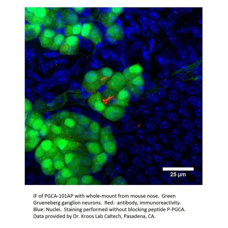 Anti-PGCA Antibody from FabGennix (PGCA-101AP) - Antibodies.com