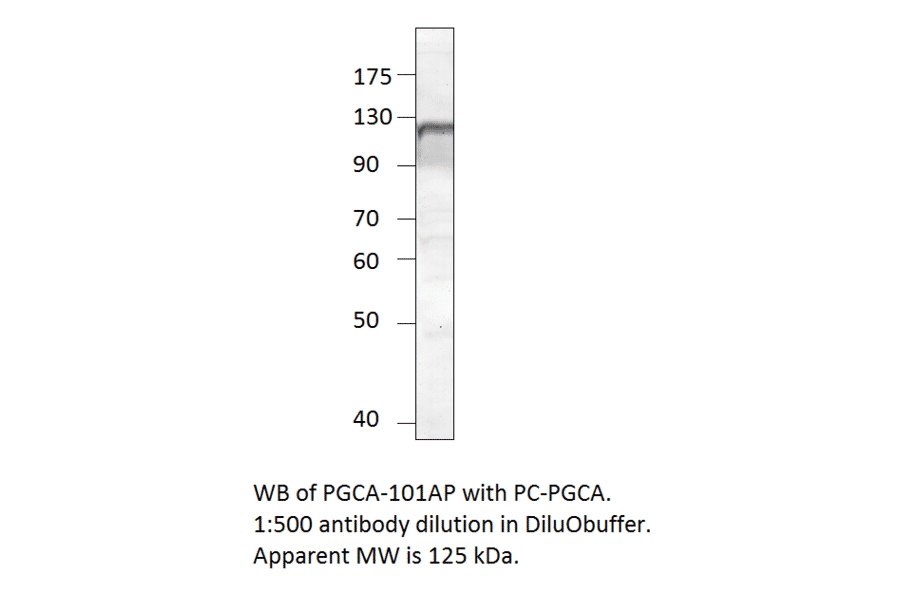 Anti-PGCA Antibody from FabGennix (PGCA-101AP) - Antibodies.com