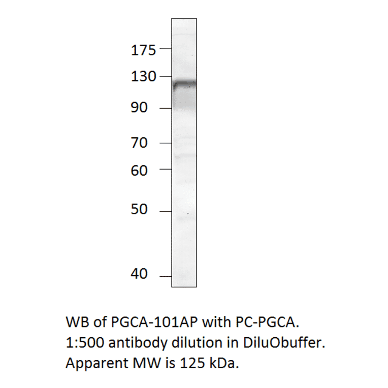 Anti-PGCA Antibody from FabGennix (PGCA-101AP) - Antibodies.com
