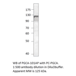 Anti-PGCA Antibody from FabGennix (PGCA-101AP) - Antibodies.com