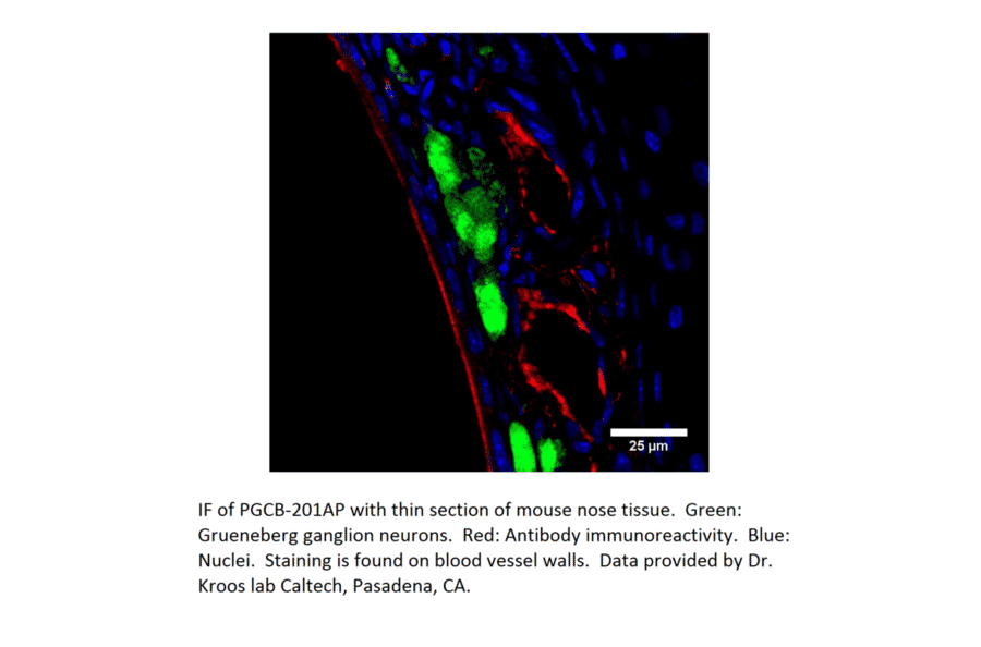 Anti-PGCB Antibody from FabGennix (PGCB-201AP) - Antibodies.com