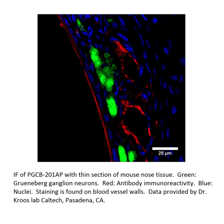 Anti-PGCB Antibody from FabGennix (PGCB-201AP) - Antibodies.com