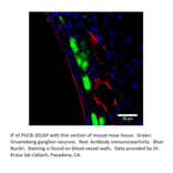 Anti-PGCB Antibody from FabGennix (PGCB-201AP) - Antibodies.com