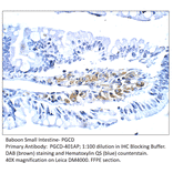 Anti-PGCD Antibody from FabGennix (PGCD-401AP) - Antibodies.com