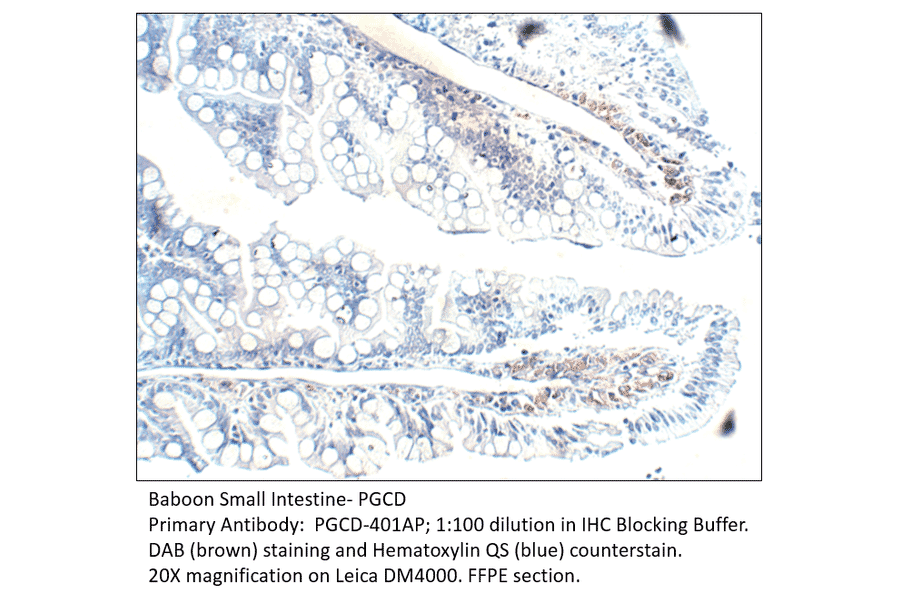 Anti-PGCD Antibody from FabGennix (PGCD-401AP) - Antibodies.com