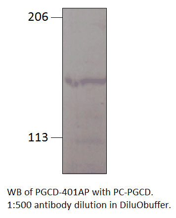 Anti-PGCD Antibody (A55061) | Antibodies.com