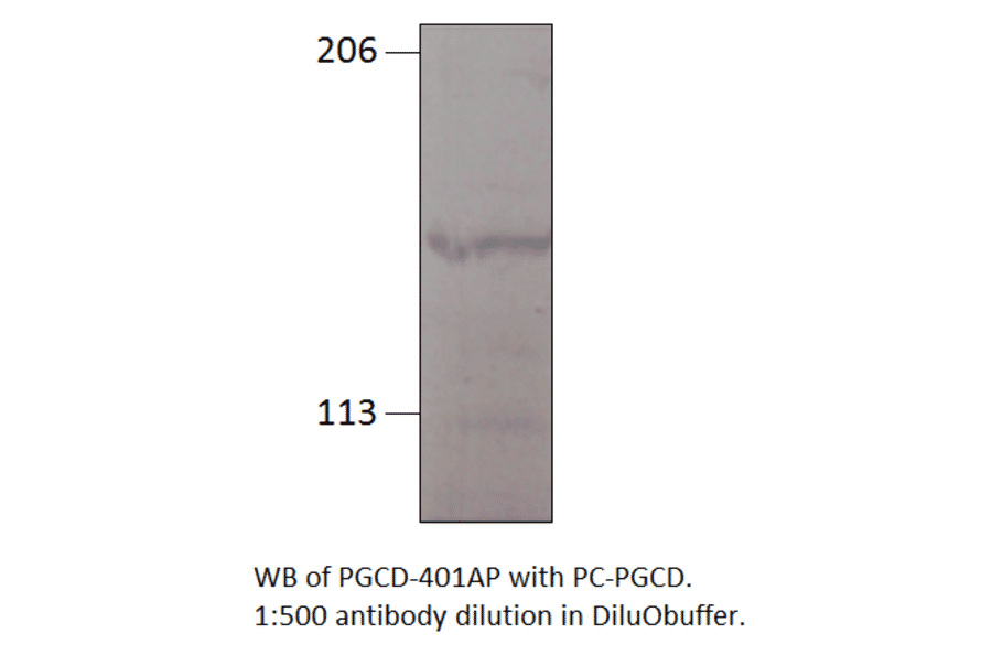 Anti-PGCD Antibody from FabGennix (PGCD-401AP) - Antibodies.com