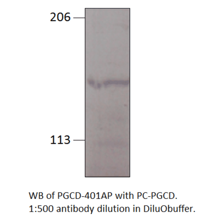 Anti-PGCD Antibody from FabGennix (PGCD-401AP) - Antibodies.com