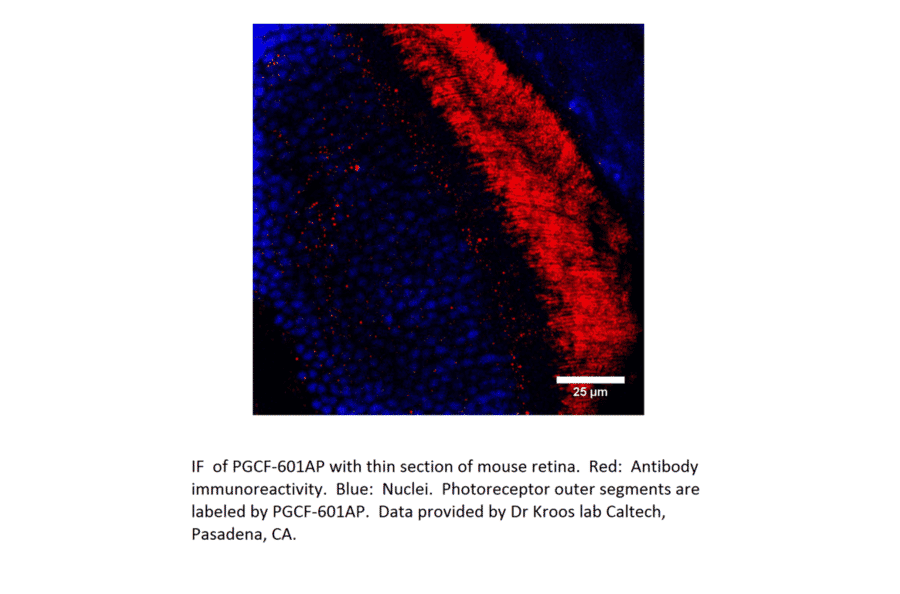 Anti-PGCF Antibody from FabGennix (PGCF-601AP) - Antibodies.com