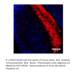 Anti-PGCF Antibody from FabGennix (PGCF-601AP) - Antibodies.com