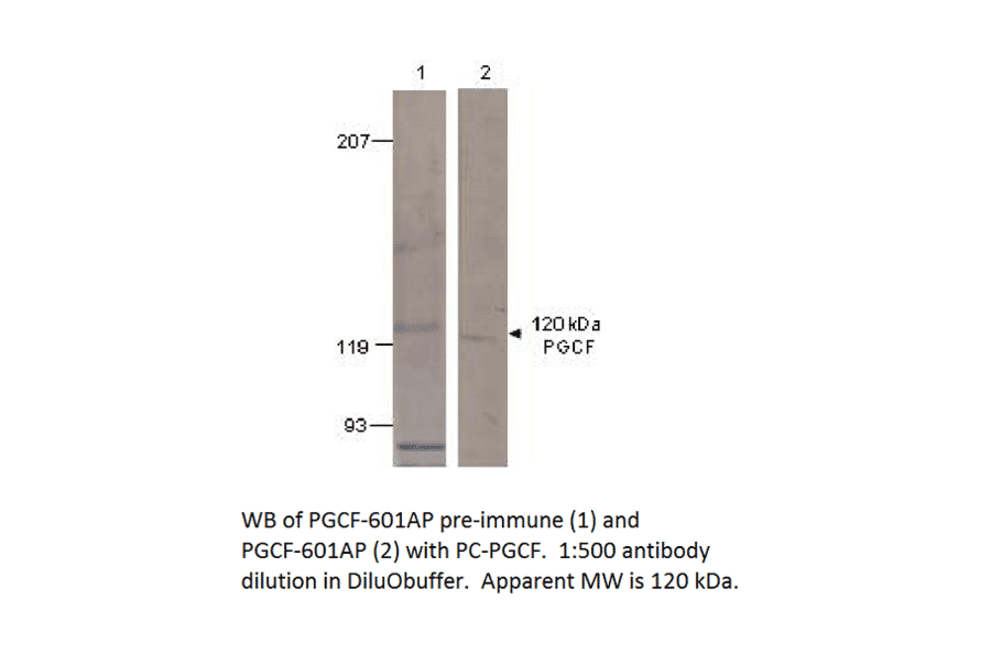Anti-PGCF Antibody from FabGennix (PGCF-601AP) - Antibodies.com