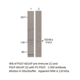 Anti-PGCF Antibody from FabGennix (PGCF-601AP) - Antibodies.com