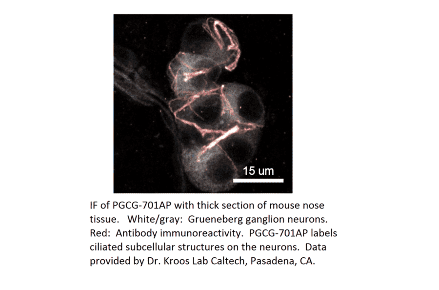 Anti-PGCG Antibody from FabGennix (PGCG-701AP) - Antibodies.com