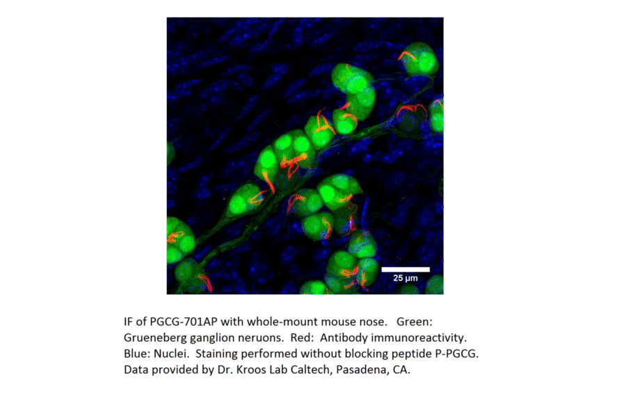Anti-PGCG Antibody from FabGennix (PGCG-701AP) - Antibodies.com