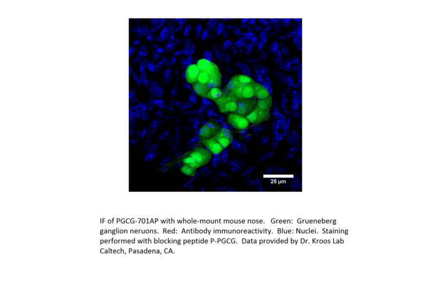 Anti-PGCG Antibody from FabGennix (PGCG-701AP) - Antibodies.com