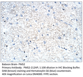 Anti-PMS2 Antibody from FabGennix (PMS2-212AP) - Antibodies.com