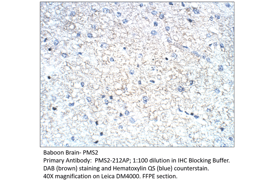 Anti-PMS2 Antibody from FabGennix (PMS2-212AP) - Antibodies.com