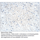 Anti-PMS2 Antibody from FabGennix (PMS2-212AP) - Antibodies.com