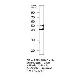 Anti-RCE1 Antibody from FabGennix (RCE1-101AP) - Antibodies.com