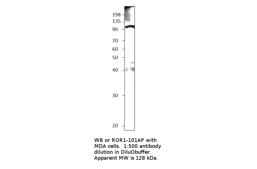 Anti-ROR1 Antibody from FabGennix (ROR1-101AP) - Antibodies.com