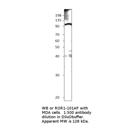 Anti-ROR1 Antibody from FabGennix (ROR1-101AP) - Antibodies.com