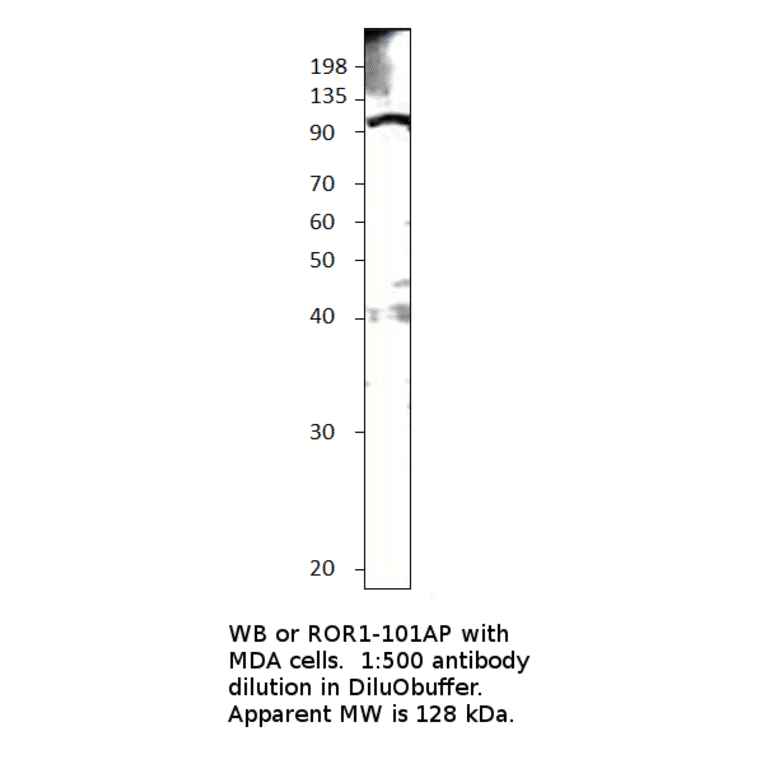 Anti-ROR1 Antibody from FabGennix (ROR1-101AP) - Antibodies.com