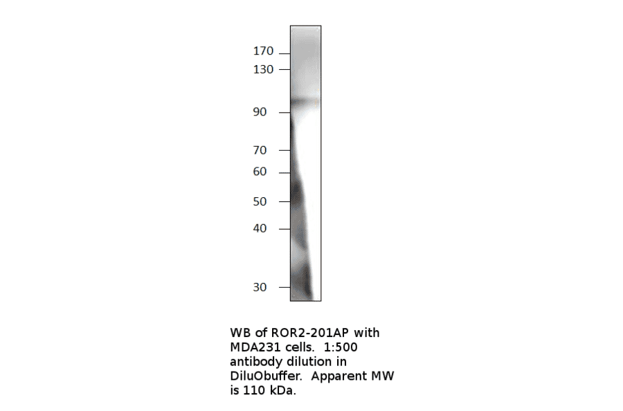 Anti-ROR2 Antibody from FabGennix (ROR2-201AP) - Antibodies.com