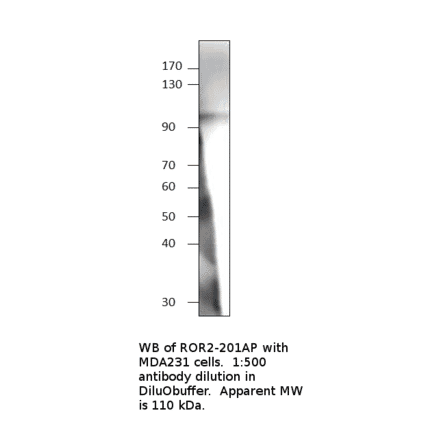 Anti-ROR2 Antibody from FabGennix (ROR2-201AP) - Antibodies.com