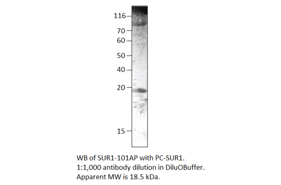 Anti-SUR1 Antibody from FabGennix (SUR1-101AP) - Antibodies.com