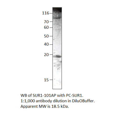 Anti-SUR1 Antibody from FabGennix (SUR1-101AP) - Antibodies.com
