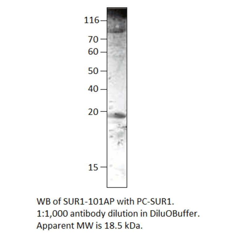 Anti-SUR1 Antibody from FabGennix (SUR1-101AP) - Antibodies.com