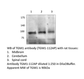 Anti-TGM1 Antibody from FabGennix (TGM1-112AP) - Antibodies.com