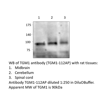 Anti-TGM1 Antibody from FabGennix (TGM1-112AP) - Antibodies.com