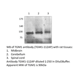 Anti-TGM1 Antibody from FabGennix (TGM1-112AP) - Antibodies.com
