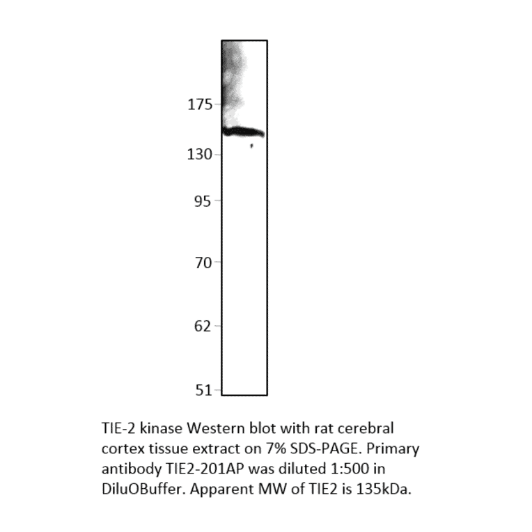 Anti-TIE2 Antibody from FabGennix (TIE2-201AP) - Antibodies.com