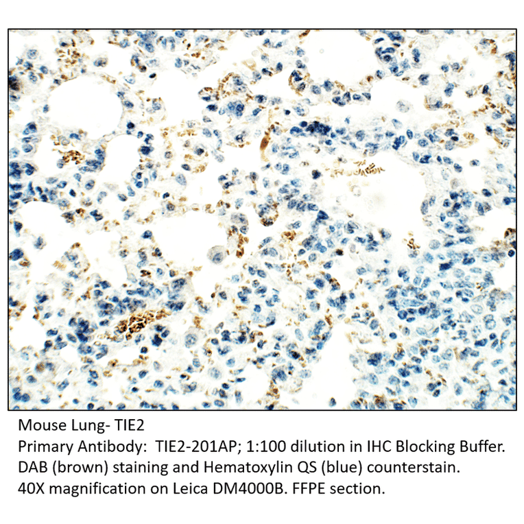 Anti-TIE2 Antibody from FabGennix (TIE2-201AP) - Antibodies.com