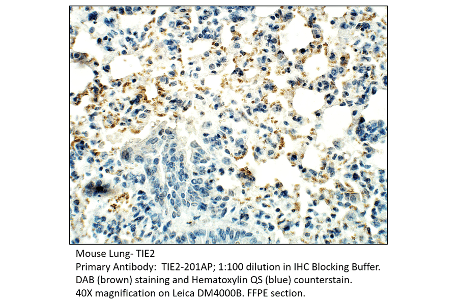 Anti-TIE2 Antibody from FabGennix (TIE2-201AP) - Antibodies.com