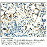 Anti-TIE2 Antibody from FabGennix (TIE2-201AP) - Antibodies.com