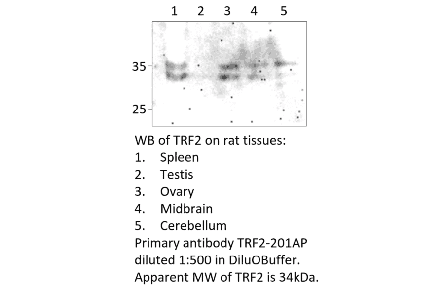 Anti-TRF2 Antibody from FabGennix (TRF2-201AP) - Antibodies.com