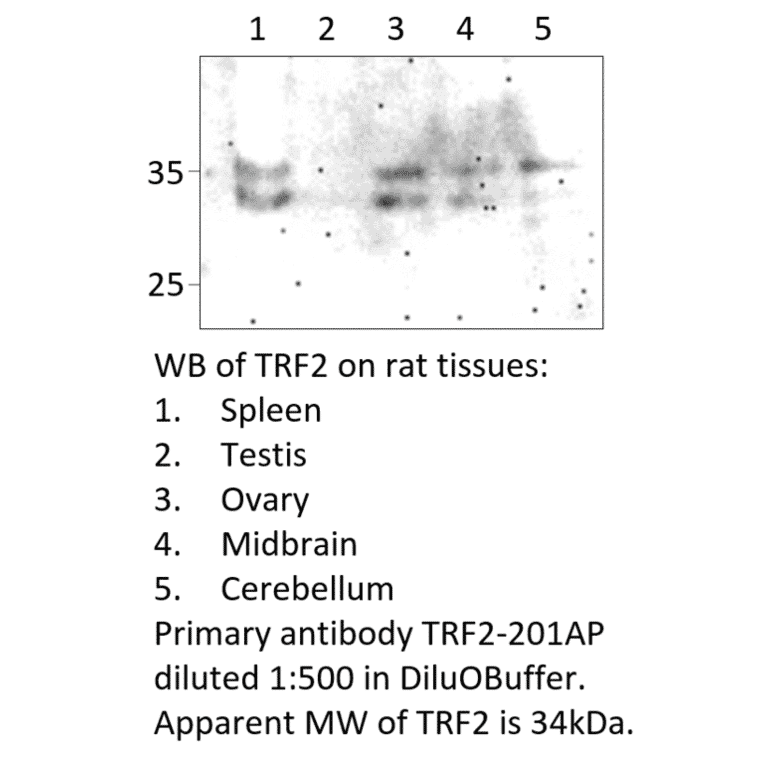 Anti-TRF2 Antibody from FabGennix (TRF2-201AP) - Antibodies.com