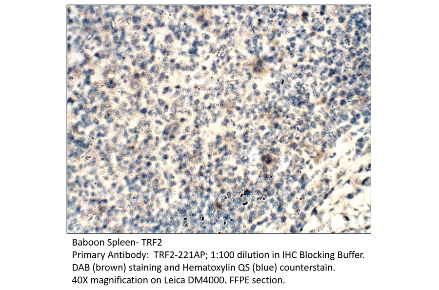 Anti-TRF2 Antibody from FabGennix (TRF2-221AP) - Antibodies.com