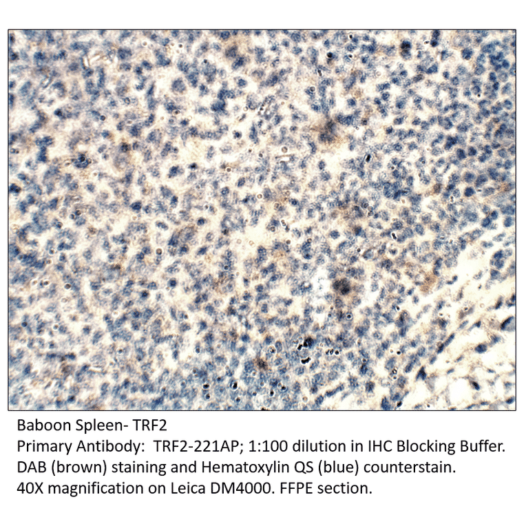 Anti-TRF2 Antibody from FabGennix (TRF2-221AP) - Antibodies.com